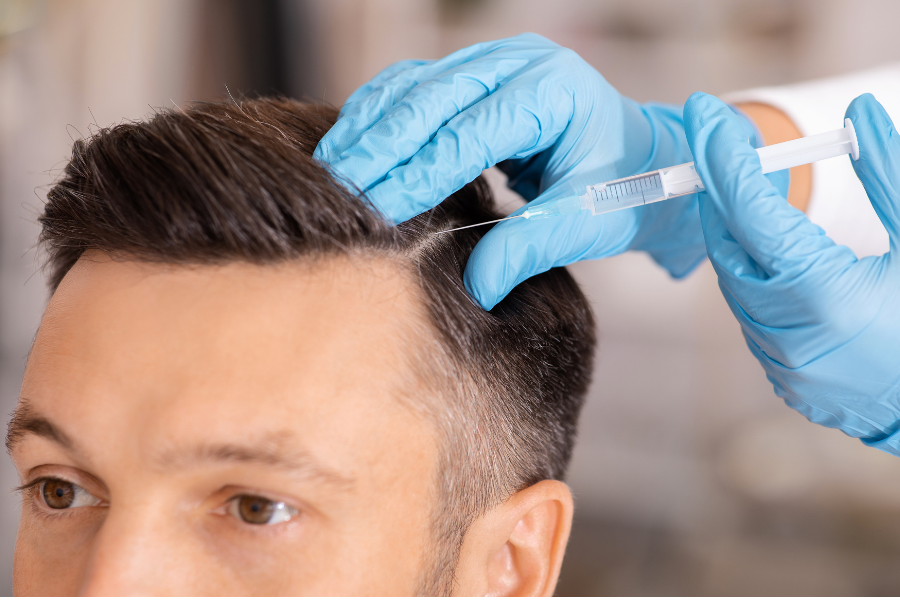 prp hair loss treatment, cosmedica stratford-upon-avon